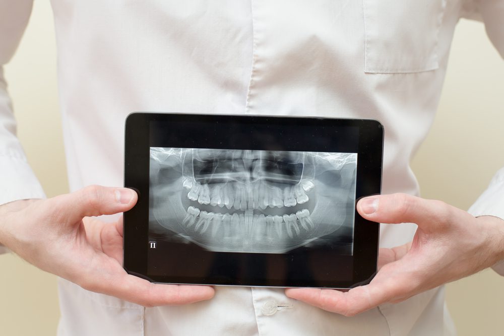 troutman dentist - digital x-rays